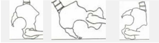 Pelvis — Anterior / Posterior