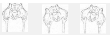 Pelvis — Rotación