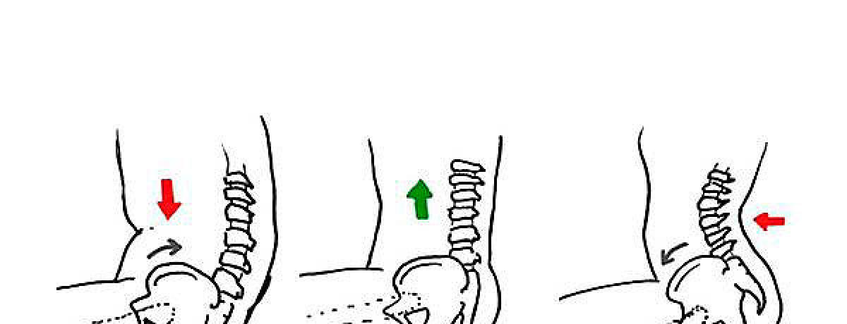 Usuario con correcto posicionamiento pélvico y de tronco en silla de ruedas