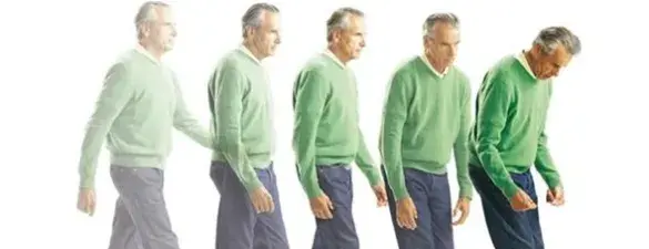 Día Mundial del Parkinson